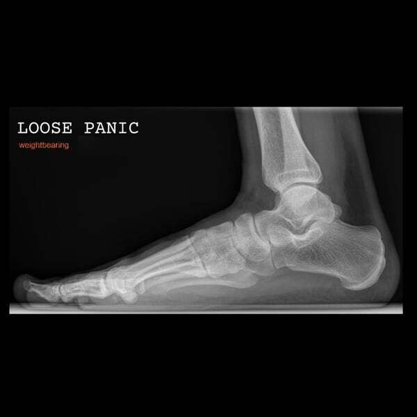 Cover art for Weightbearing